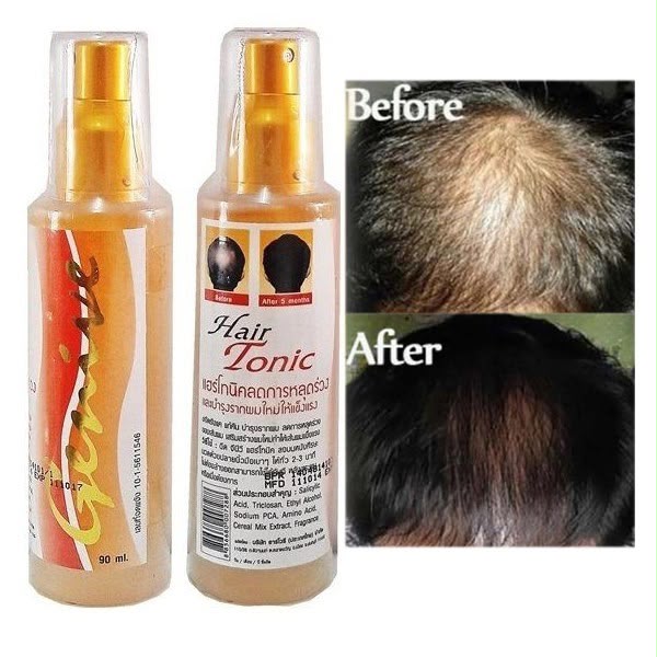 Genive Genive Hair Tonic for Hair Regrowth